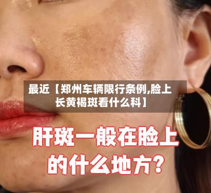 最近【郑州车辆限行条例,脸上长黄褐斑看什么科】-第3张图片