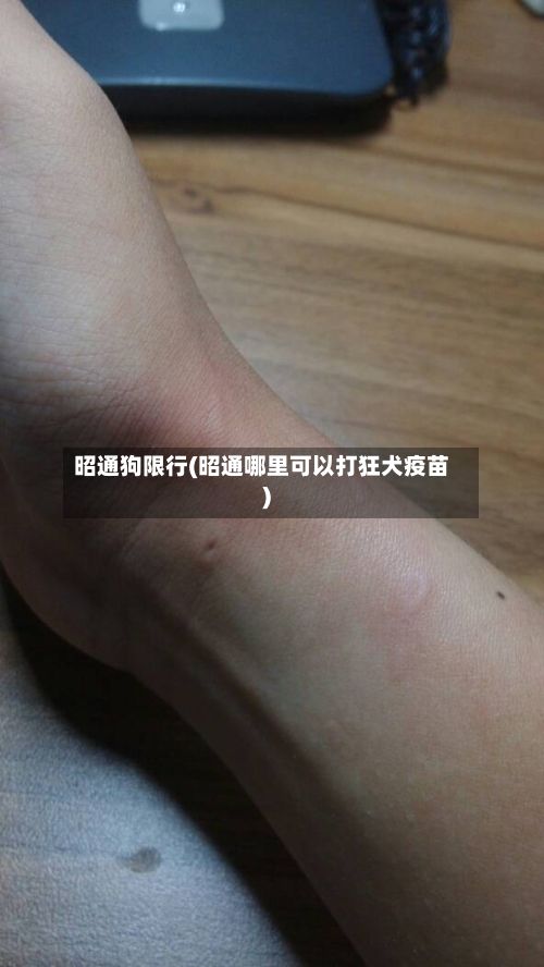 昭通狗限行(昭通哪里可以打狂犬疫苗)