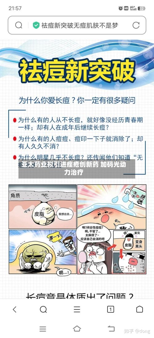 亚太药业拟引进痤疮创新药 加码光动力治疗-第1张图片